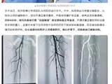 打通“活血隧道”，张洪哲博士团队助七旬老人“枯腿逢春”