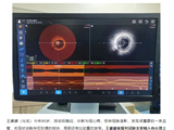 IVUS-OCT一体成像技术，一键看透你的心脏血管