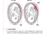 【生死时速】孕妇突发胎盘早剥，我院19分钟挽救母婴，绿色通道紧急护航母婴平安！
