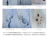 喜报！我院荣获“2024年度广东省二级医院卒中中心静脉溶栓先进单位”